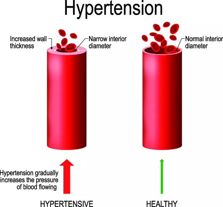 blood-pressure-graphic.jpg