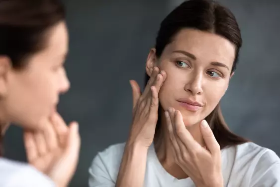 adult-acne.jpg